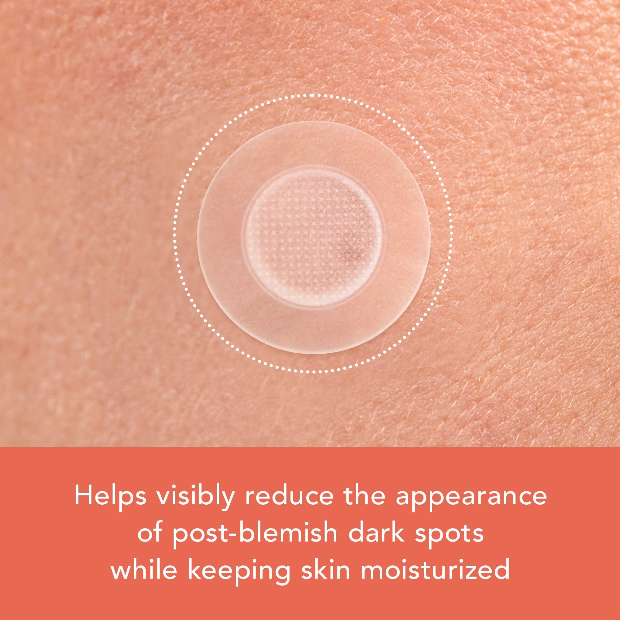 Miracle Patch Microcrystal Vitamin C Dark Spot Cover L6