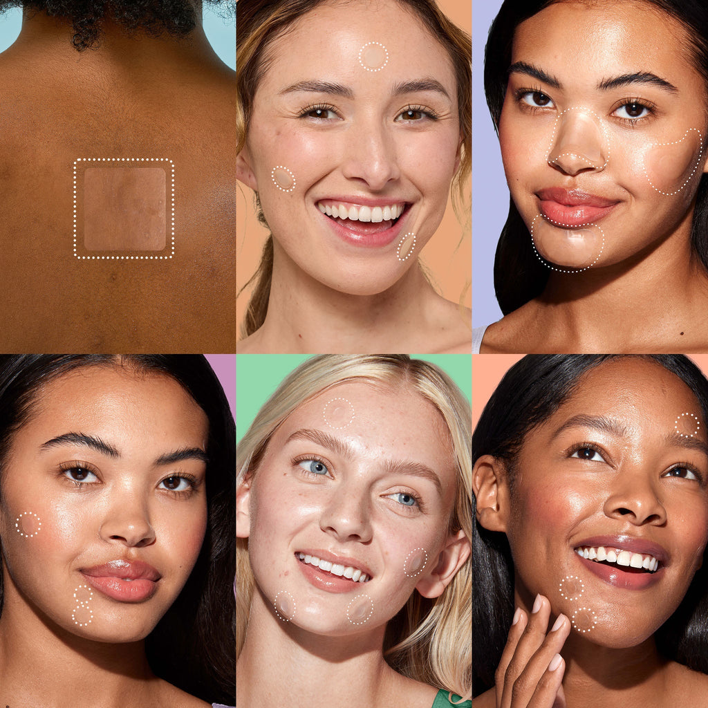 Miracle Patch Ultimate Blemish Patch Kit A7