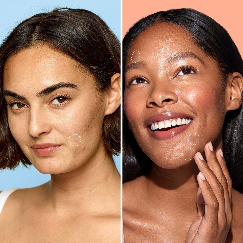 Miracle Patch Day & Night Bundle O9