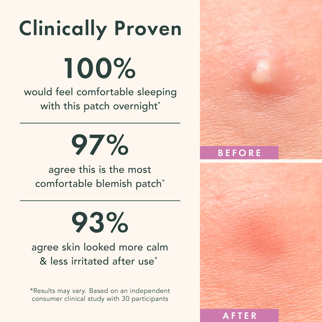 Miracle Patch Overnight Spot Cover Z9