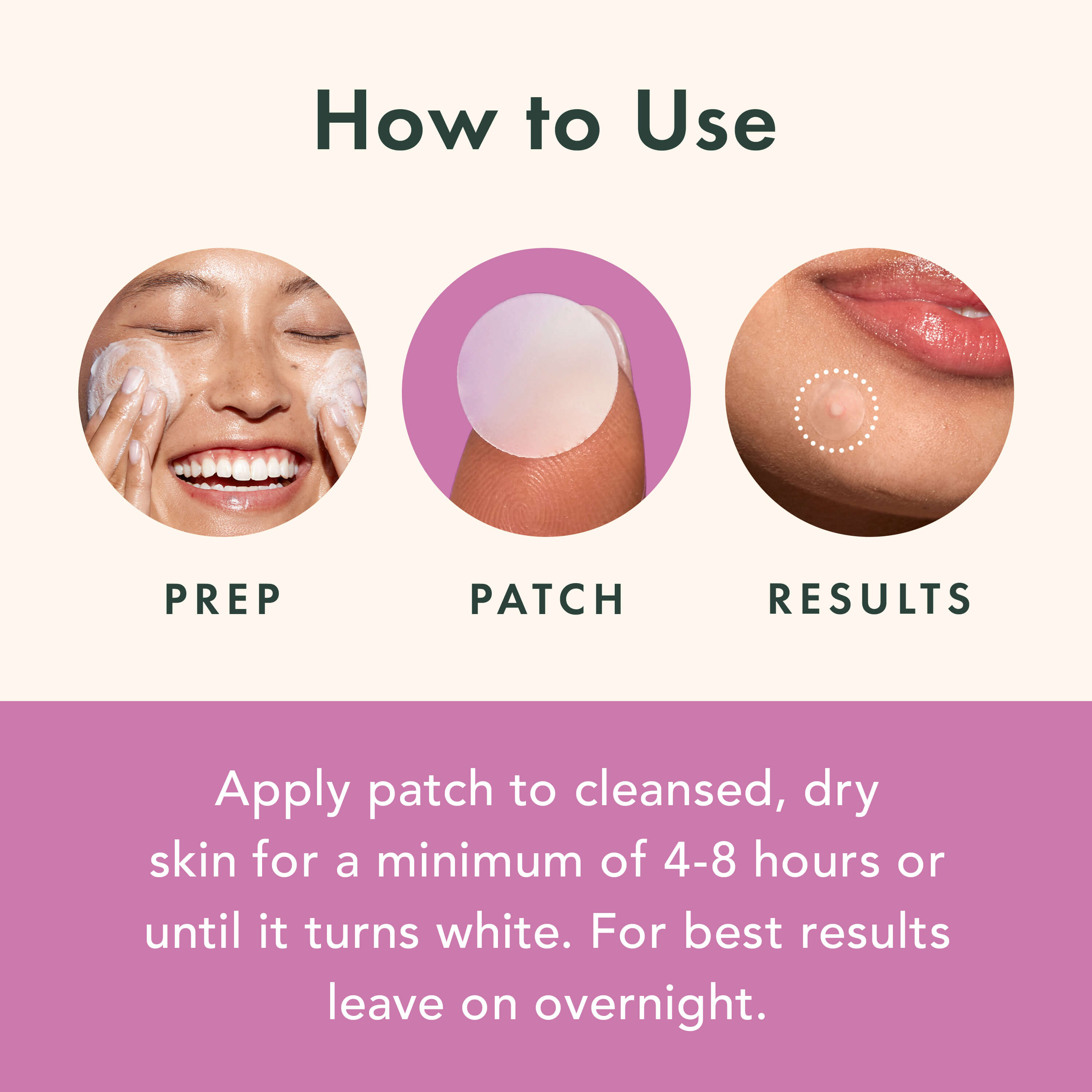 Miracle Patch Overnight Spot Cover Z9